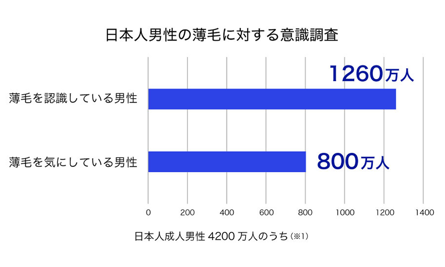 日本人男性の薄毛に対する意識調査