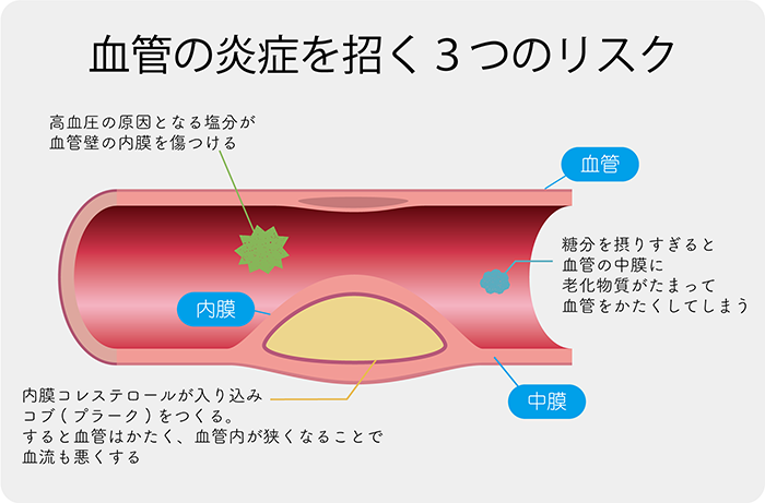 血管の炎症と衰えていく３つの原因