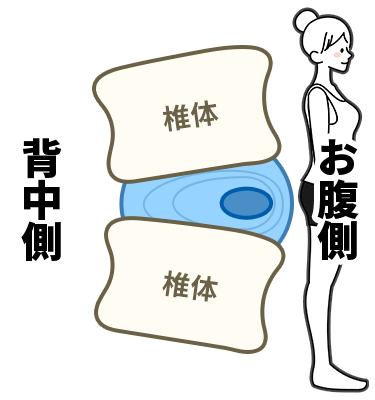 「腰痛もち」とあきらめない！簡単にできる腰痛予防
