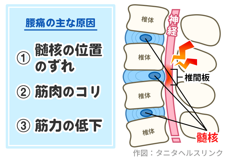 「腰痛もち」とあきらめない！簡単にできる腰痛予防